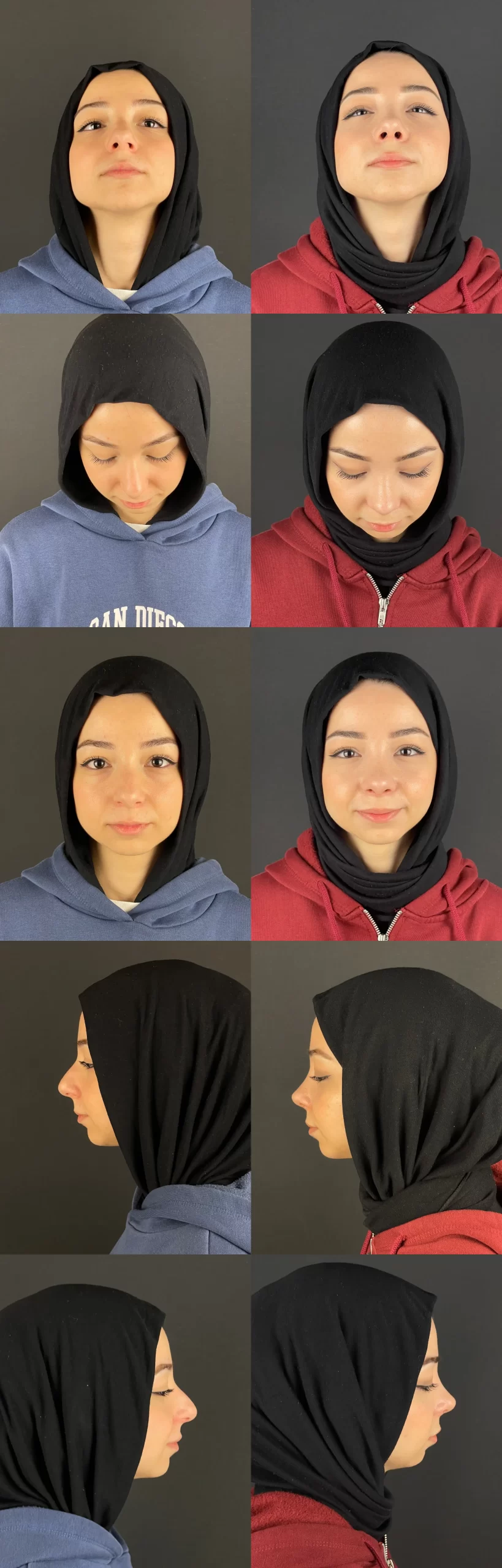 Rhinoplasty patient showing subtle and natural enhancements from various angles, highlighting balanced results.