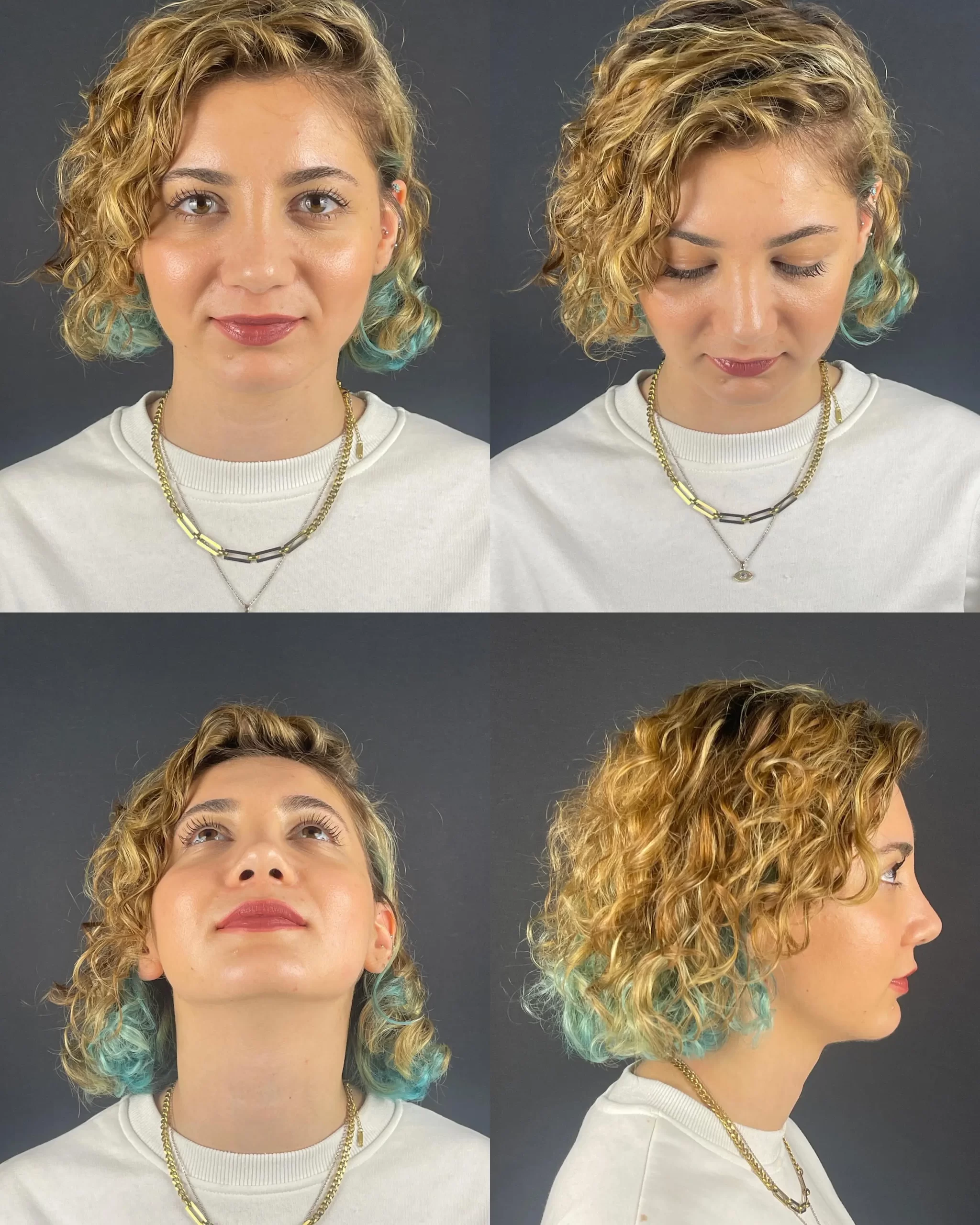 Rhinoplasty patient showing vibrant and balanced results from various angles, highlighting natural beauty and confidence.